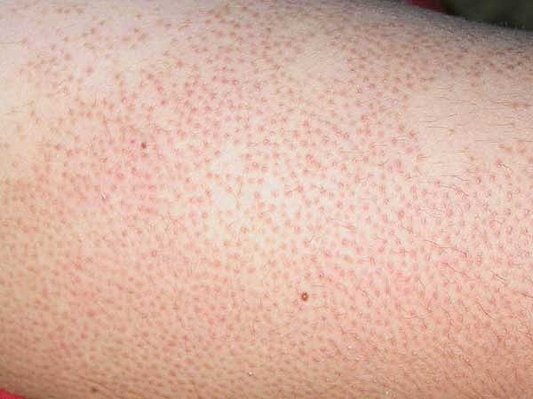 O que são essas manchas ou 