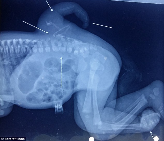 indiana-com-tres-pernas_01