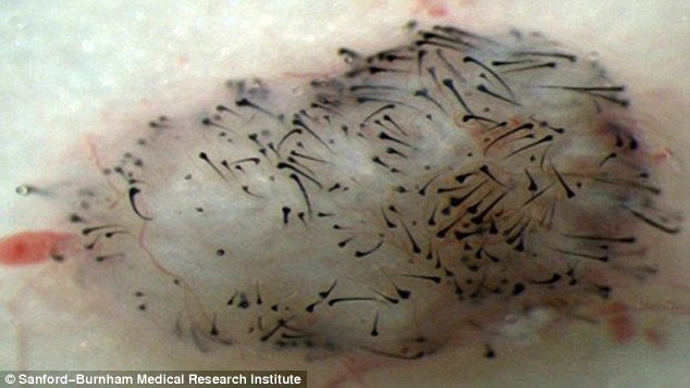 Ano passado os cientistas de Orlando, nos EUA, conseguiram dar um passo importante, ao desenvolver um tratamento usando células estaminais humanas para fazer fios de cabelo crescerem novamente. Na imagem, os fios cresceram na perna de um rato adulto. 