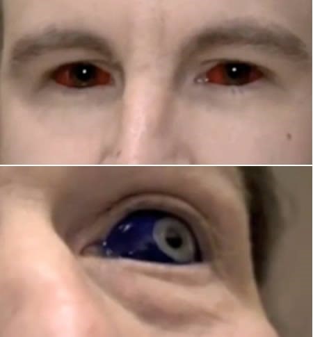 Presidiários ganharam fama mundial após tatuarem os olhos. 