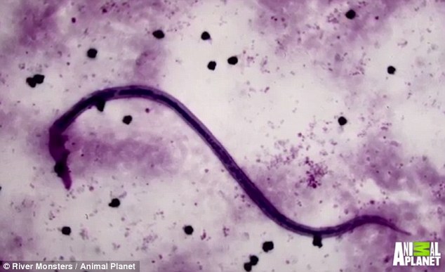pinworm lárva stádium ikerparazita mi ez