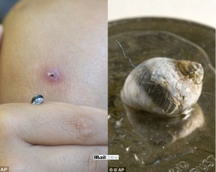 caracol-vivendo-no-joelho_01