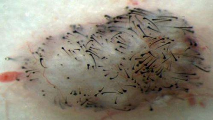 celulas-tronco-pluripotentes-para-nascer-cabelo_01