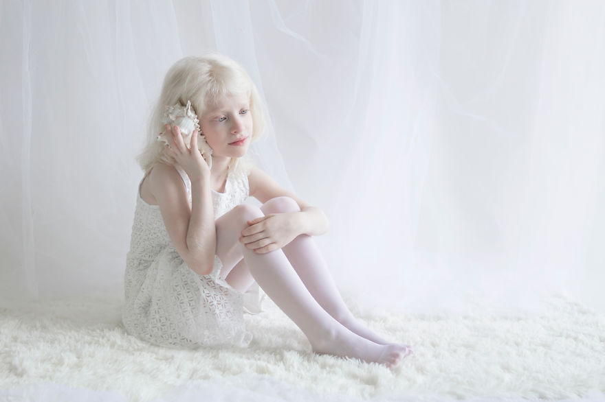 fotos-que-exaltam-a-beleza-albina_10