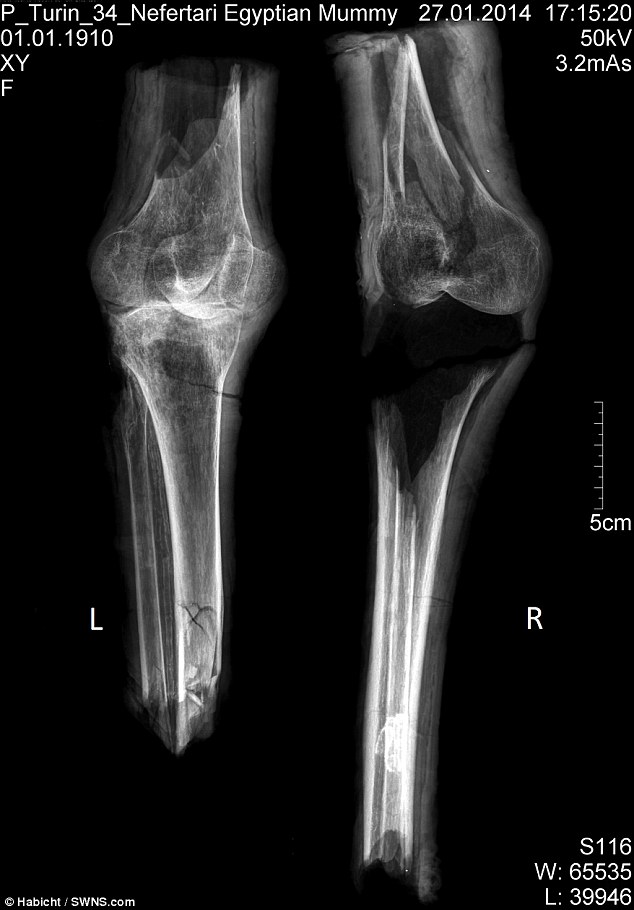 membros-mumificados-da-rainha-nefertari_03