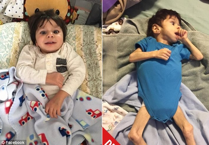 menino-abandonado-morrendo-de-fome_01