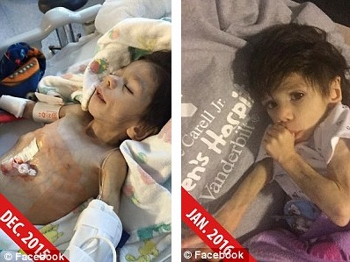 menino-abandonado-morrendo-de-fome_06