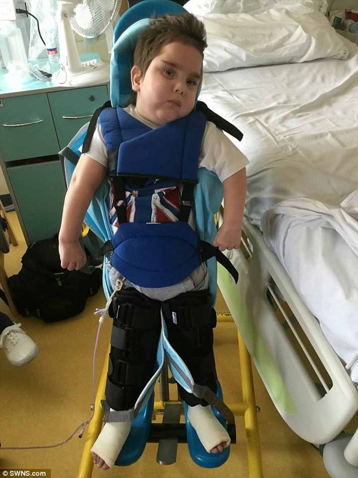 menino-dano-cerebral_02