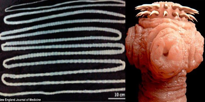 27-casos-medicos-mais-estranhos_1