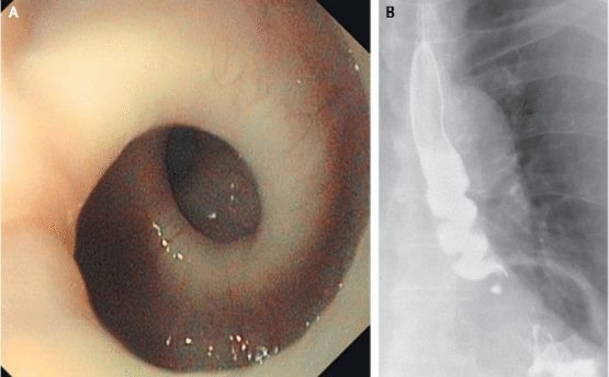 27-casos-medicos-mais-estranhos_11