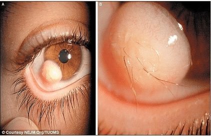 27-casos-medicos-mais-estranhos_13