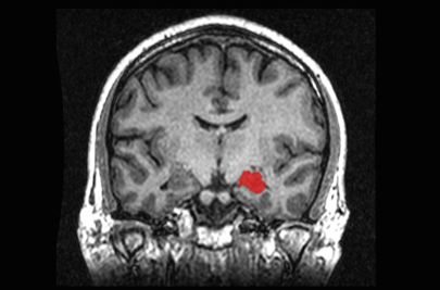 27-casos-medicos-mais-estranhos_18