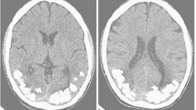27-casos-medicos-mais-estranhos_21