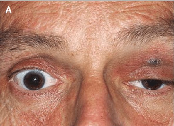 27-casos-medicos-mais-estranhos_3