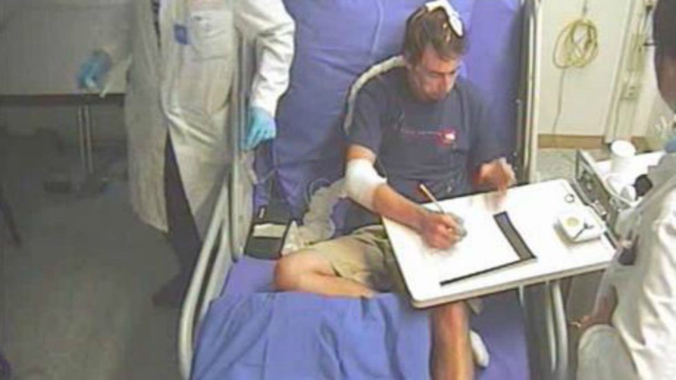 27-casos-medicos-mais-estranhos_4