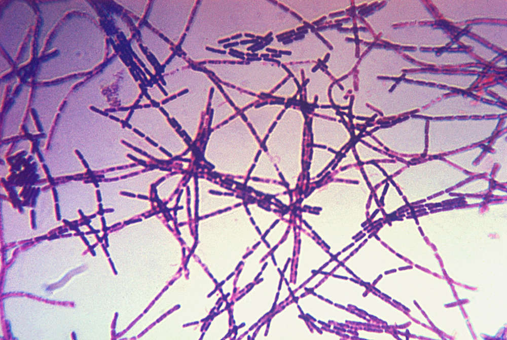 bacillus-anthracis-gram