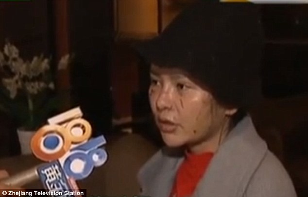 mulher-tem-rosto-desfigurado_1