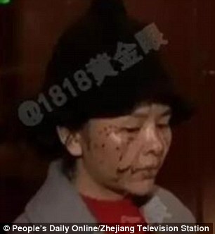 mulher-tem-rosto-desfigurado_2