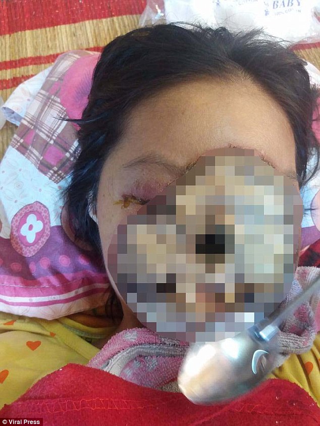 atriz-tem-rosto-destruido_1