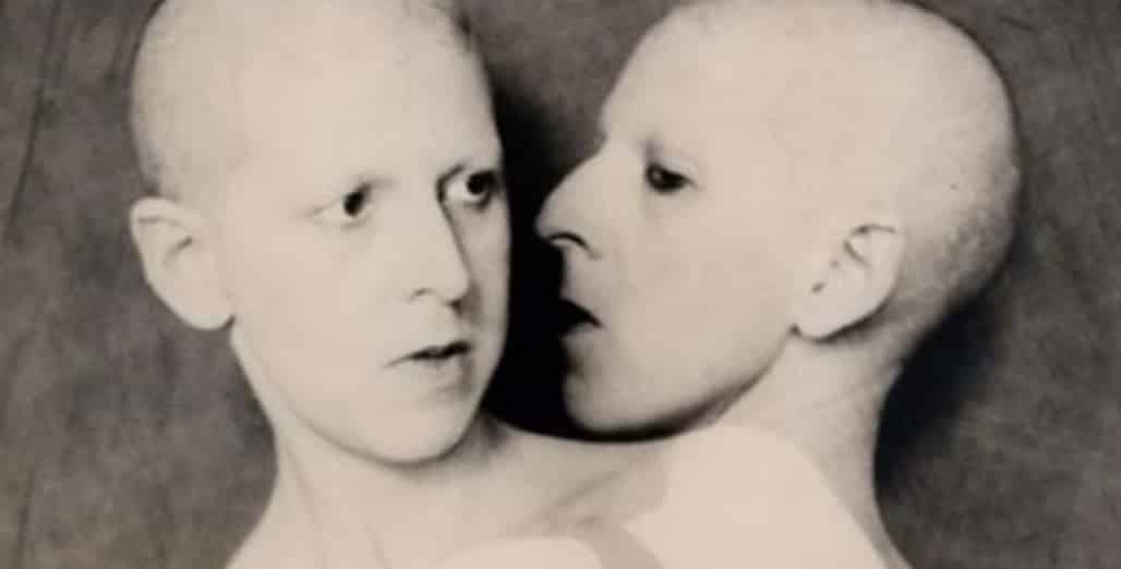 Conheça a história de Herculine Barbin, uma hermafrodita que confundiu