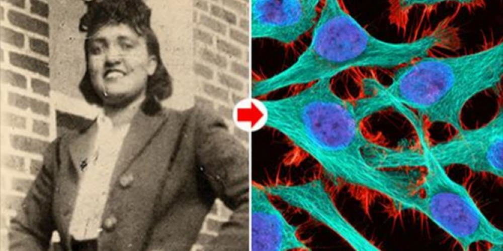 Henrietta Lacks dona das células HeLa