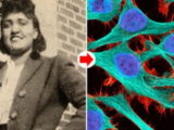Henrietta Lacks dona das células HeLa