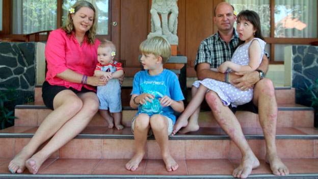 pais-submetem-filha-a-tratamento-que-inibe-o-crescimento_1