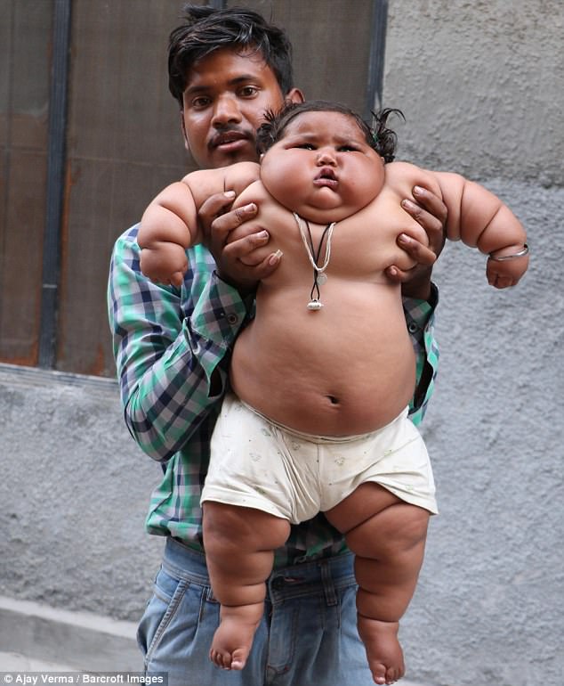 menina-obesa_03