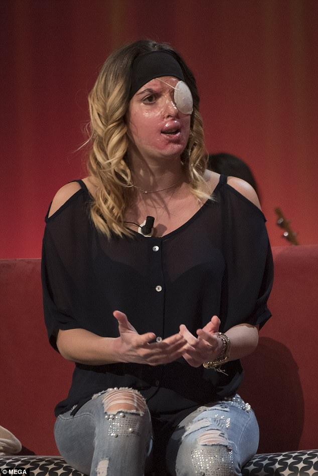 modelo-atacada-com-acido_1