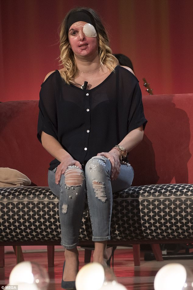 modelo-atacada-com-acido_2