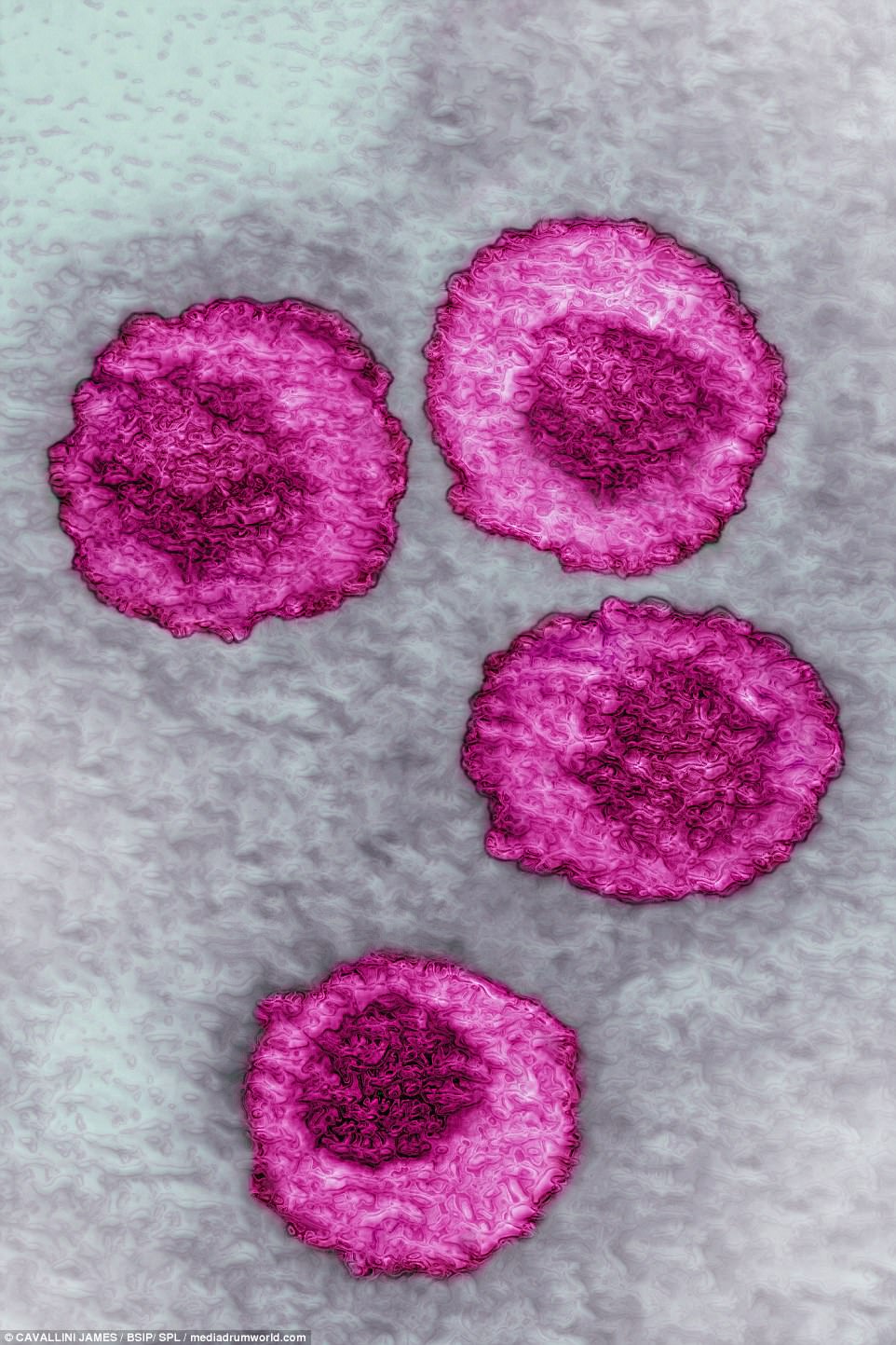 virus-02