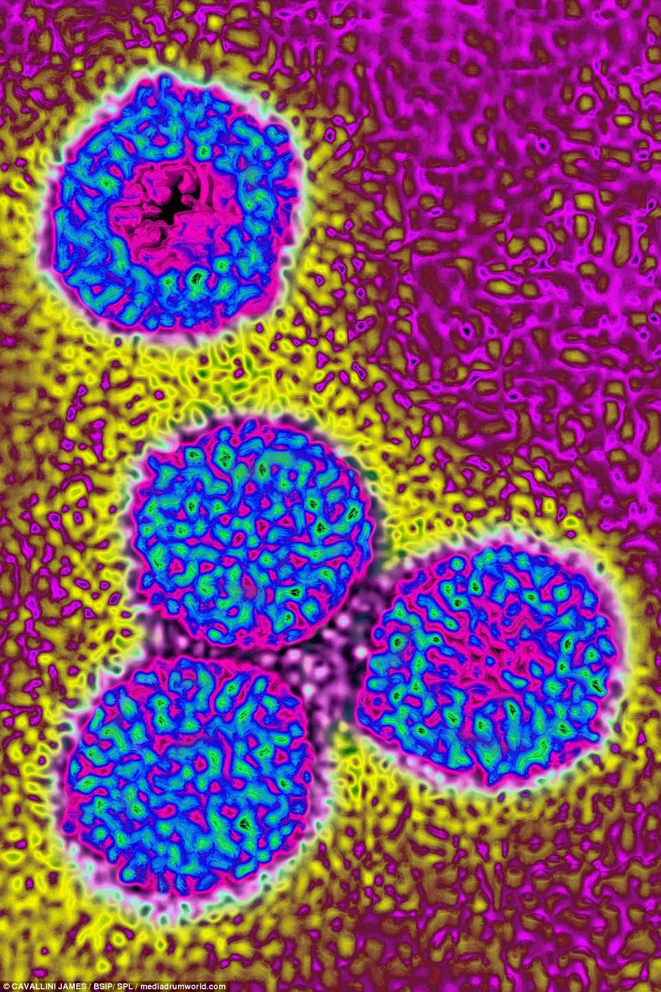 virus-03