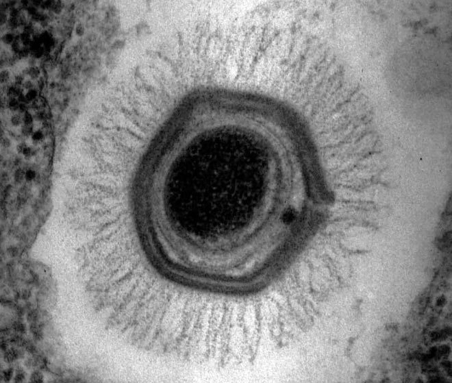 virus-gigante-frankenstein-1