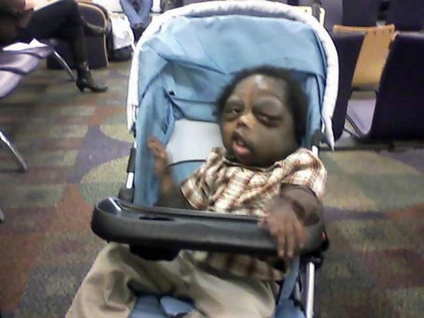 PAY-DEADLY-TUMOURS-RAVAGE-BOYS-FACE (1)