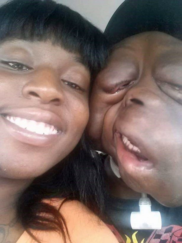 PAY-DEADLY-TUMOURS-RAVAGE-BOYS-FACE (2)