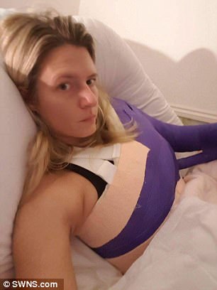 mulher-sofre-comm-doenca-invisivel_3