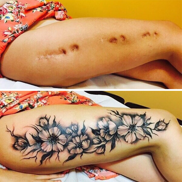 tatuagens-cicatriz-1