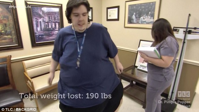 homem-obeso-35kgs_1